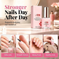 💅 PROMO FLASH : 50% DE RÉDUCTION ! Soin Fortifiant & Durcisseur pour Ongles Mous et Striés – Réparateur & Brillance Naturelle for des Ongles Forts et Éclatants ✨